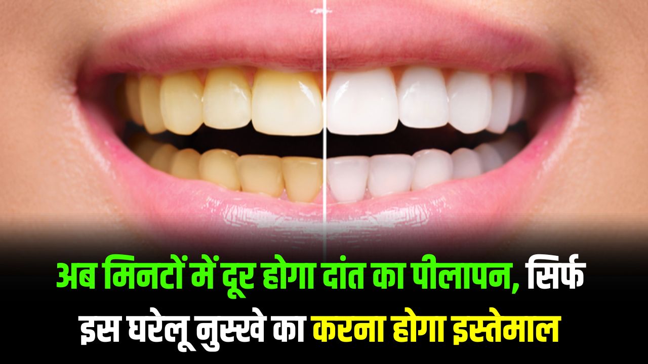 Home remedy to Whiten teeth